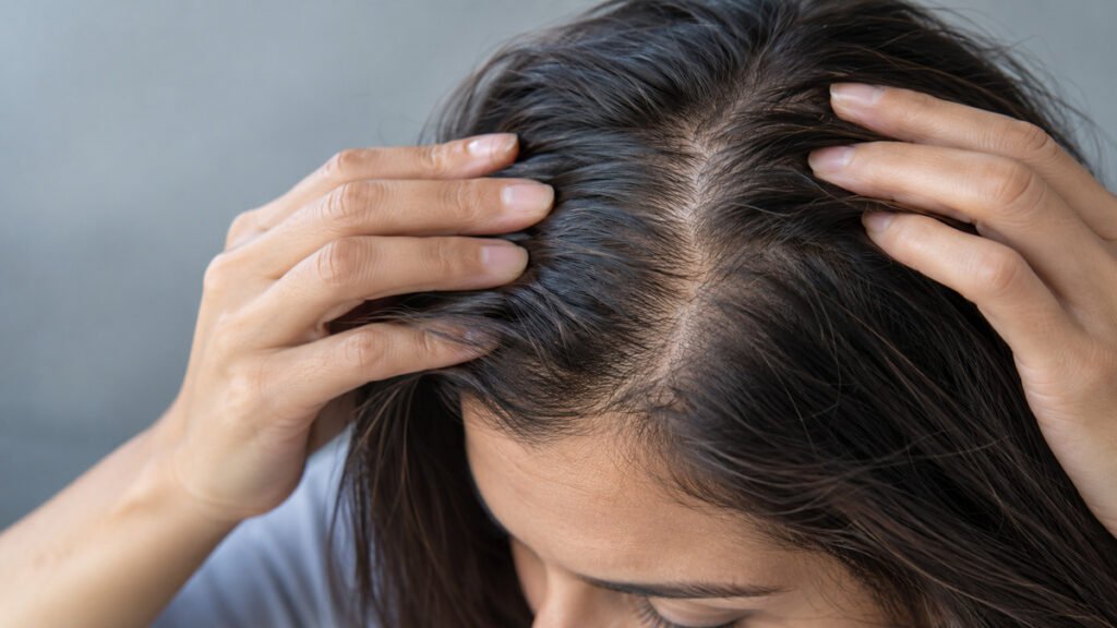 Avaliação dermatológica da queda de cabelo e do couro cabeludo com a Dra. Paula Cabral em Recife.